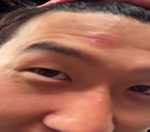 脑门肿了!孙兴慜被人推撞到了奖杯,但孙哥高兴得合不拢嘴