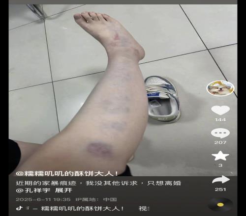 涉及篮球女主播解说员孔祥宇妻子社媒晒家暴痕迹&申请离婚