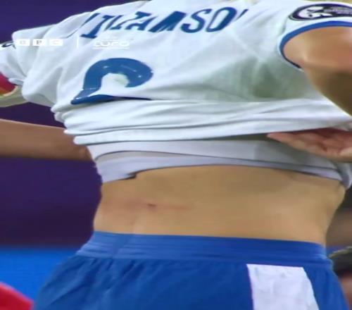 妹紙身上被鏟出血洞！BBC：這難道不是紅牌嗎