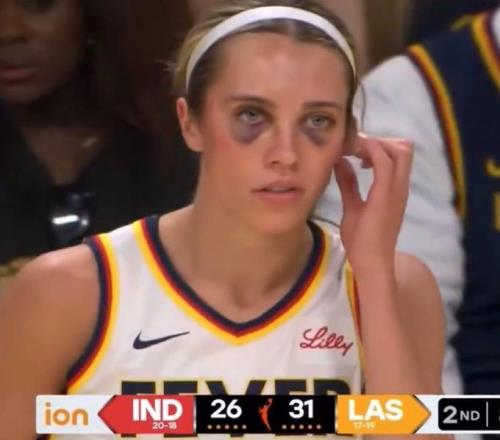 強度趕上CBA!WNBA狂熱前鋒赫爾被“打成熊貓”了