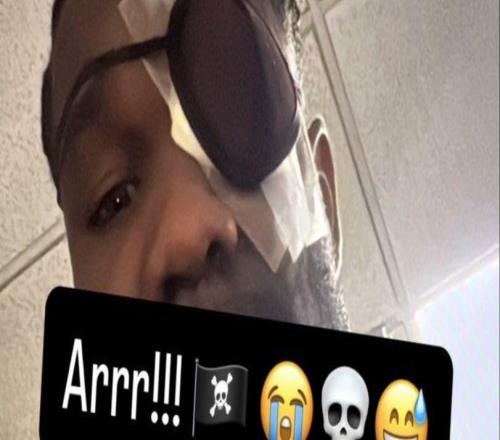 艾頓眼部受傷不忘曬自拍！雷迪克賽后調(diào)侃：他看著就像個海盜