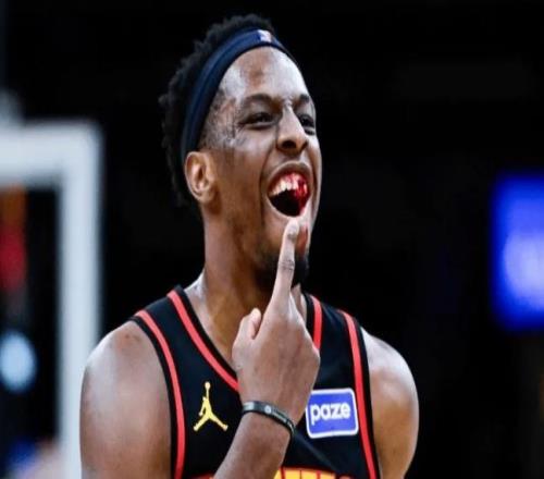 被打掉兩顆牙！老鷹官宣奧孔古成功手術(shù)缺席對陣火箭步行者兩場