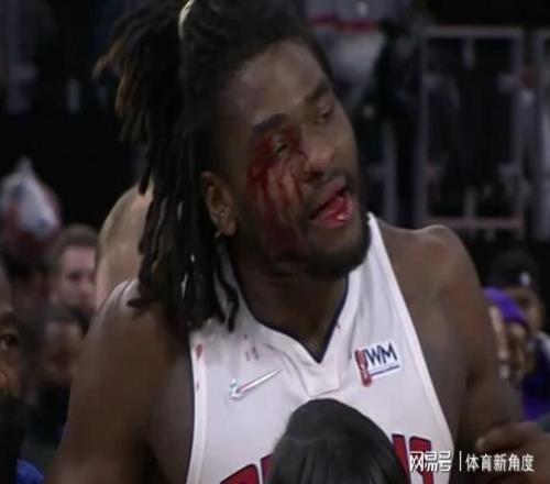 爆，無限期禁賽，血濺三尺+替補(bǔ)席爆燃，果真是血抗老詹的人