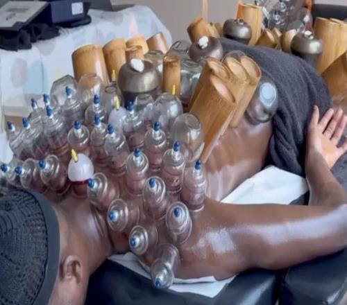 挺管用，吉拉西接受拔罐治療后在對(duì)陣美因茨時(shí)梅開(kāi)二度