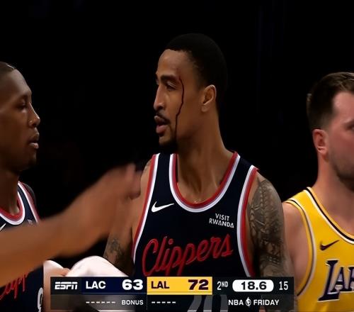 80+15+24！湖人三巨頭爆發(fā)，倫納德31分&傷退，新援轟26分難救主