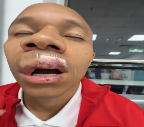 遭姜至鵬肘擊！蓉城外援重傷：嘴唇縫15針+牙齒脫位，下輪或缺戰(zhàn)