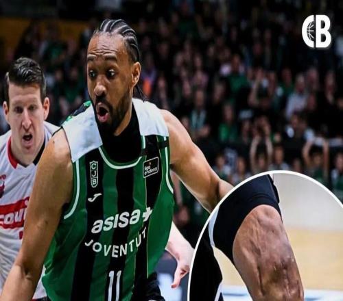 好可怕的膝蓋！兩次ACL撕裂，他還在打球?。?！