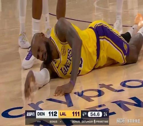 臥槽！詹姆斯曬傷口！直呼：疼死我了...