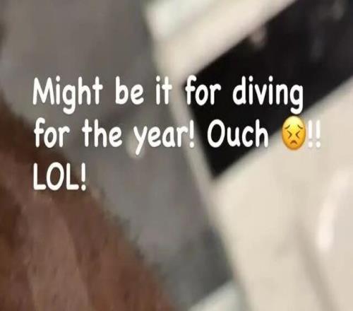 滲人！詹姆斯曬血肉傷口！真的太拼了.....