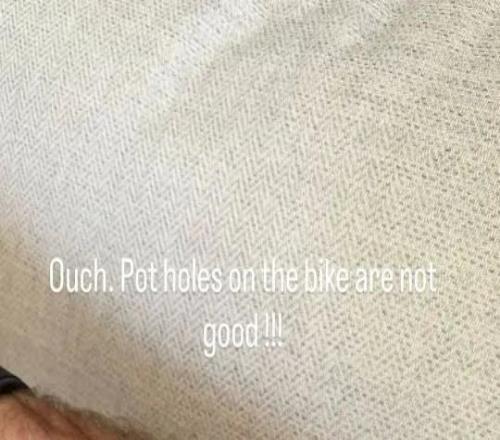 希勒騎車時(shí)因路面坑洞摔傷，手部和腿部有多處擦傷