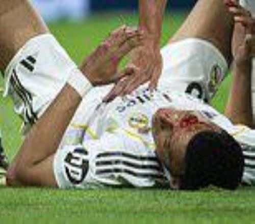 姆巴佩血染賽場(chǎng)VAR裝死，皇馬主帥：這球在月球都是點(diǎn)球