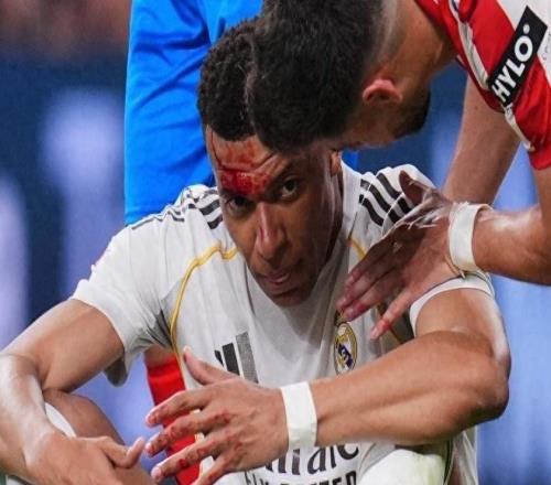 皇馬：姆巴佩眉骨縫合三針缺席歐冠前訓(xùn)練