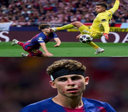 慎入，費爾明被穆索用鞋釘蹬中面部，鮮血直流