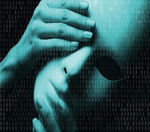 坎寧安39分孤掌難鳴：活塞主場為何開局即崩盤