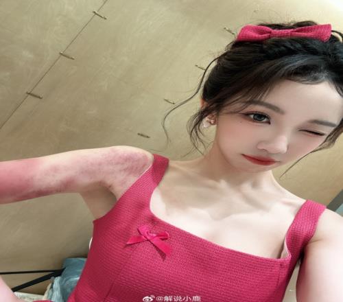 真战损版加鹿鹿！解说小鹿晒照：如何呢，那又怎